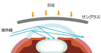 紫外線が隙間から入り込んだ様子